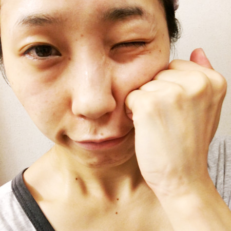 かばにゃん さんのシミウス 薬用ホワイトニングリフトケアジェルの口コミ評判レポート コスメニスト