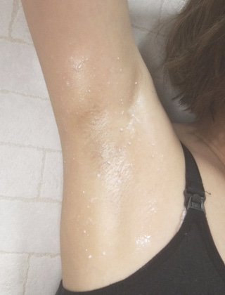 中絶 死にかけている り 脇 の ピーリング E Systems Jp